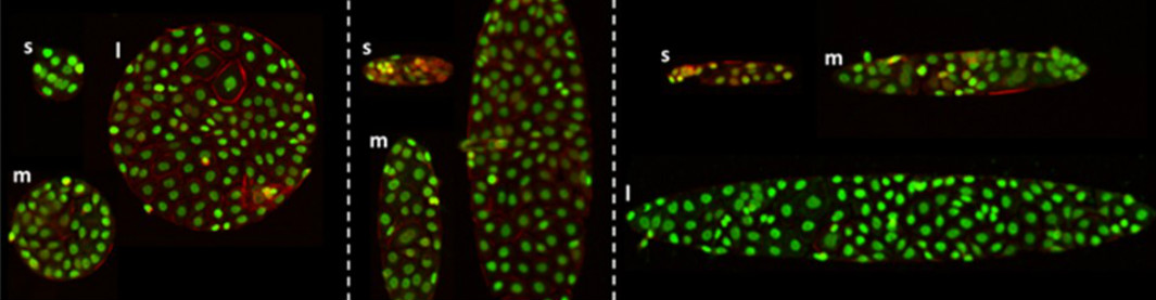 Micro-patterned <em>in vitro</em> model of keratinocyte colonies