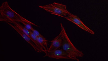 Primary cilia in bone cells