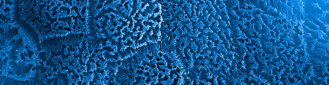 Microvilli inside Emulate's intestine-chip