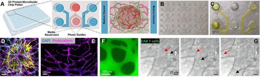 A. Schematic representation of microvascularised chips with embedded ovarian cancer model. B-C. Images from a microfluidic chip plate. D. Example of spheroid (cardiac in this case; cTnT, yellow; NG2, cyan; CD31, magenta) embedded in microvascularised chips (stable up to 4 weeks of culture). E-F. Confirmation of network maturity (E, podocalyxin staining; F, FITC-dextran perfusion assay). G. CAR T cells (green) perfusing within microvascularised ovarian cancer models.