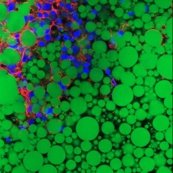 Ovarian cancer cell migrate in adipomimetic biomaterials
