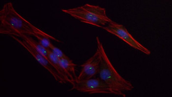 Primary cilia in bone cells