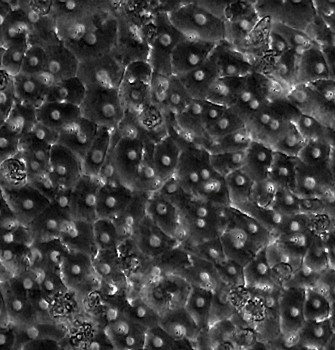 Hepatocytes cultured in Emulate's Liver chip
