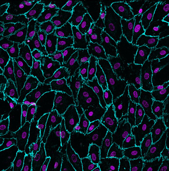 Human Kidney chip