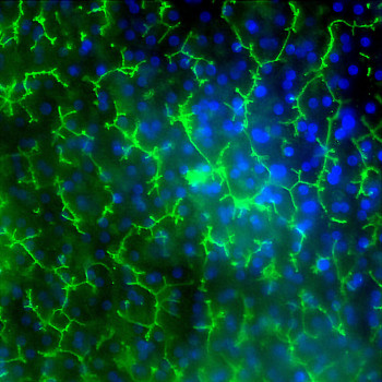 Emulate's Liver chip, MRP2 staining