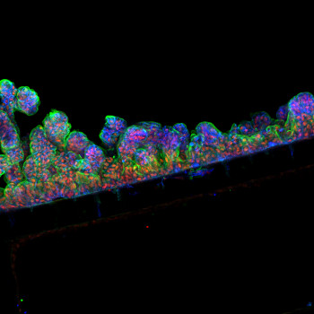 Cells of the intestinal lining in Emulate's intestine chip, image credit Cedars-Sinai Board of Governors Regenerative Medicine Institute