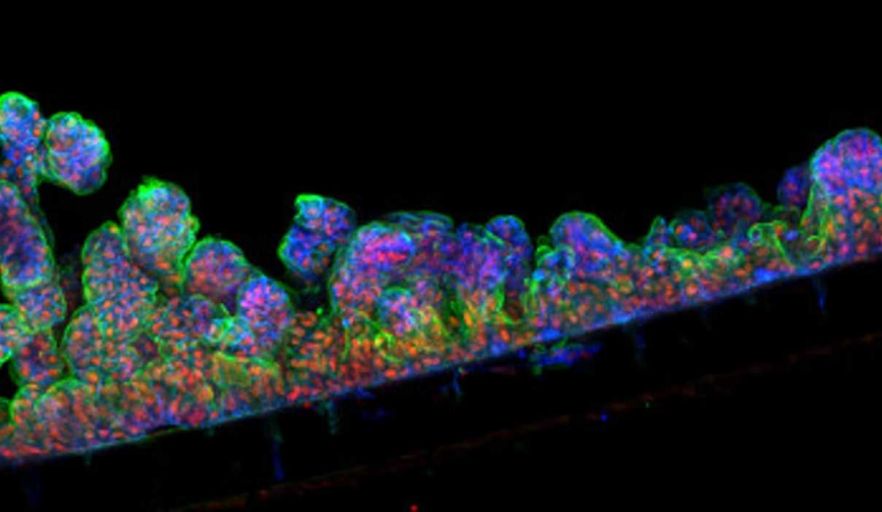 Organ-chip model