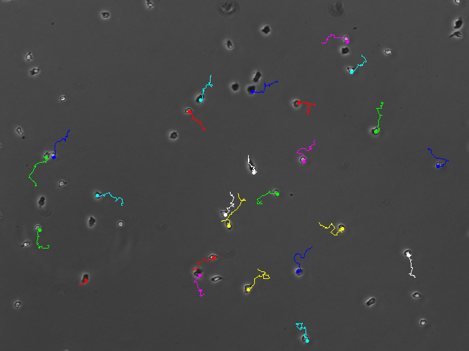 microscopy - cell tracking